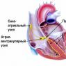 Ав узел сердца Схема строения проводящей системы сердца