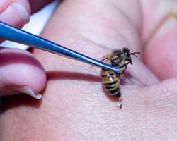 Лечение укусами пчел: показания к применению апитерапии